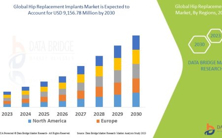 Swiss Hip Replacement Implants Market Insights and Growth Trends
