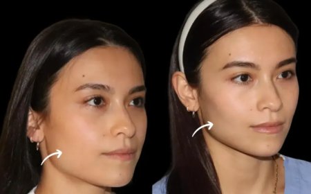 Eco-Friendly Practices in Sculptra Fillers at Dubai’s Best Aesthetic Clinic