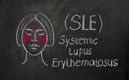 Systemic Lupus Erythematosus: A Comprehensive Overview