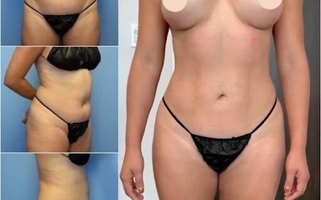 Discover Best Doctors in Dubai for Body Contouring and Sculpt Your Ideal Shape