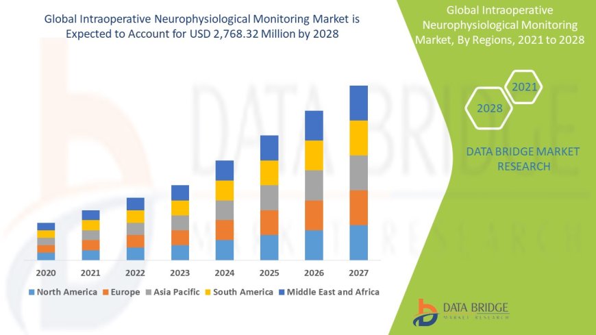 Intraoperative Neurophysiological Monitoring Market Production, Demand and Business Outlook 2028