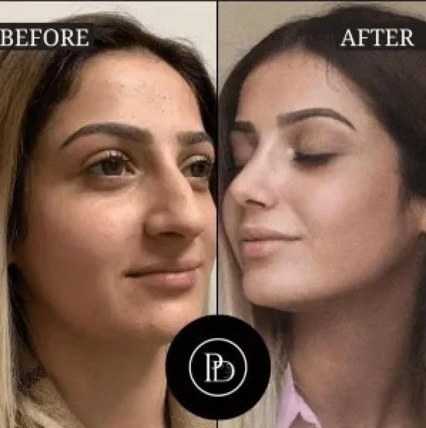 Best Time of Year to Get PRP Treatment in Dubai