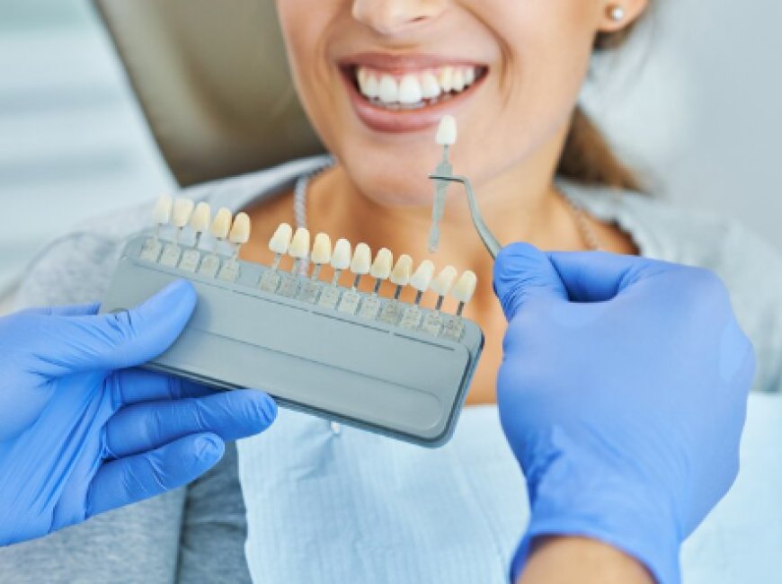 Before You Book: Tips for Choosing a Local Dental Crown Specialist
