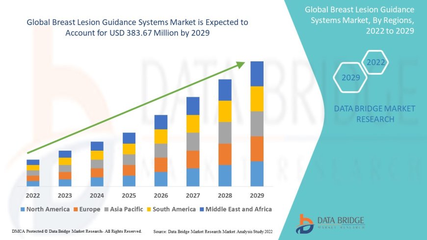 Breast Lesion Guidance Systems Market Size, Status and Industry Outlook During 2029