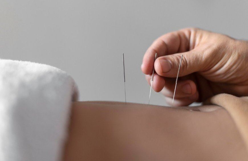 Integrating Dry Needling and Chinese Medicine: A Holistic Approach to Healing